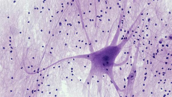 Nervous Tissue: Spinal Cord Motor Neuron. smear: spinal cord magnification: 200x